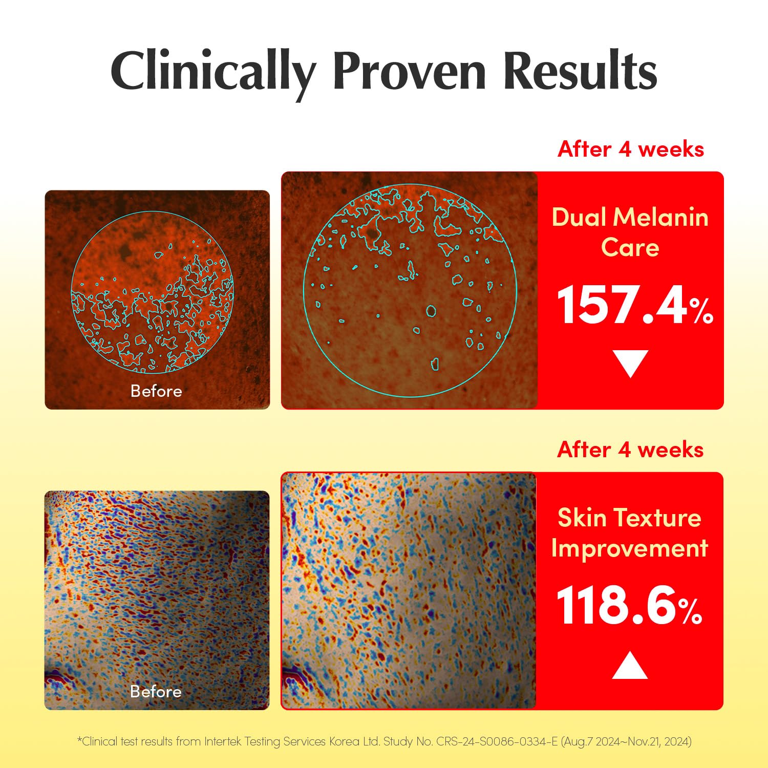 EQQUALBERRY Vitamin Illuminating Serum – Brightening Vitamin C Serum with Niacinamide | Strengthens skin barrier | Hydrates using Ceramide and Hyaluronic Acid, 1.01oz / 30ml