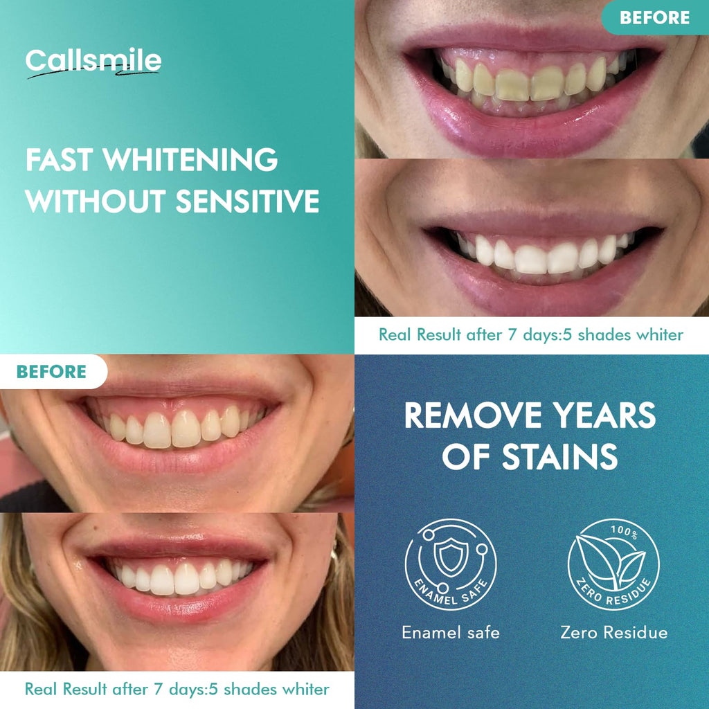 CALLSMILE Whitening Strips for Sensitive Teeth: 16 Treatments Gentle Whitening | Enamel-Safe | Deep Stains Removal | Non-Slip Dry Strips Daily Oral Care, Mint Sea Salt
